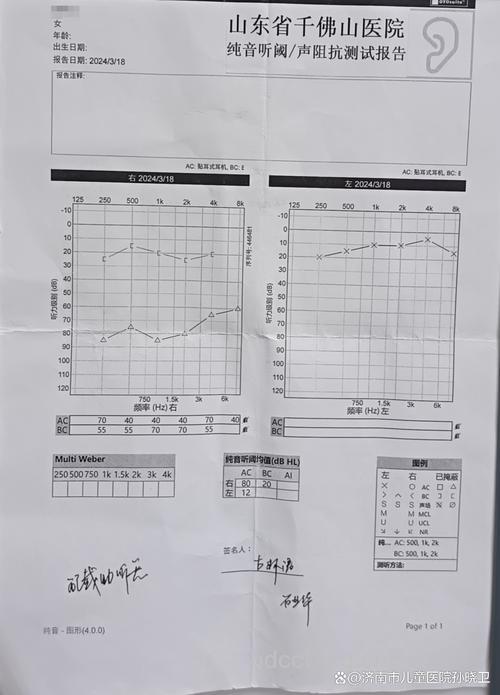 教你区分神经性与传导性耳聋