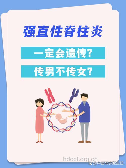 强直性脊柱会遗传吗