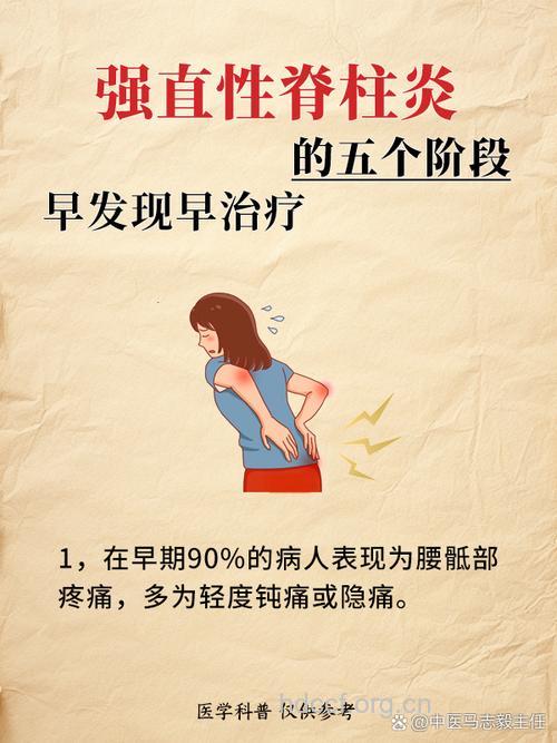 幼年强直性脊柱炎的诊断方法