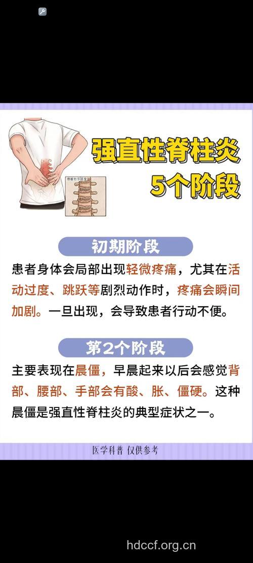 腰酸背痛是强直性脊柱炎的典型症状