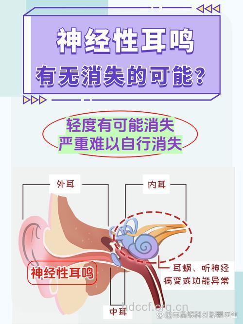什么是神经性耳鸣？