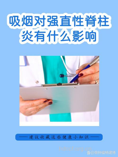 吸烟会导致强直性脊柱炎吗