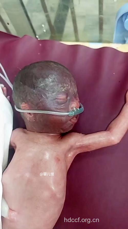惊！癌症缠上新生宝宝