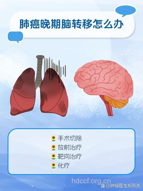 如何走出“癌症转移”误区