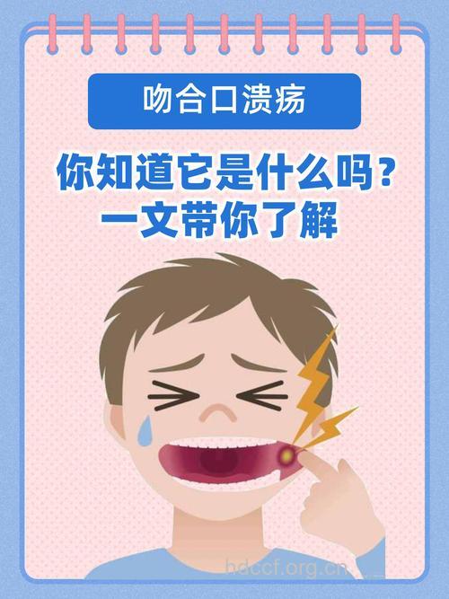 接吻也有可能引发胃溃疡