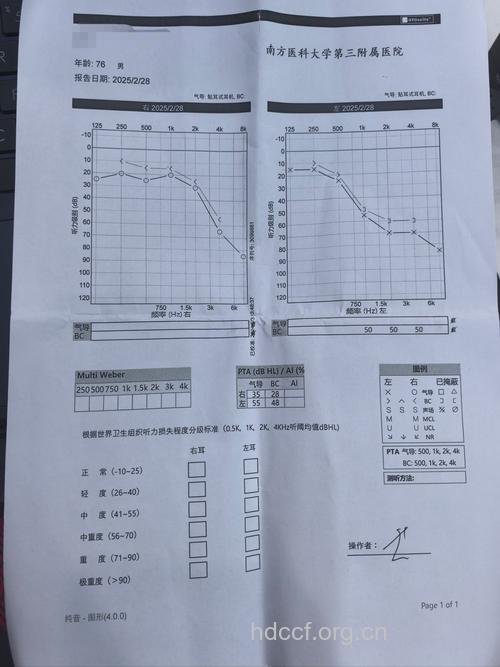 听力障碍鼓室硬化的HRCT诊断实验与结论