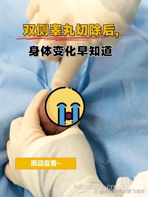 睾丸癌手术切除后会影响性生活吗