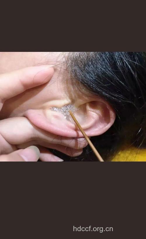 其实,耳垢能帮您护理耳朵