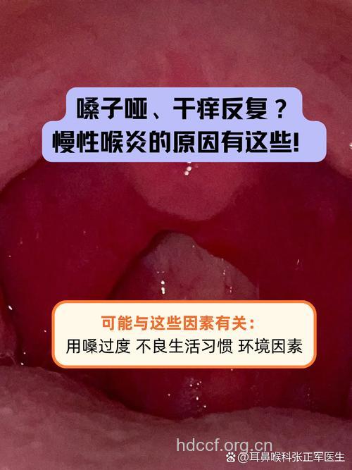 过敏性咽喉炎的症状 严重时可出现声音嘶哑