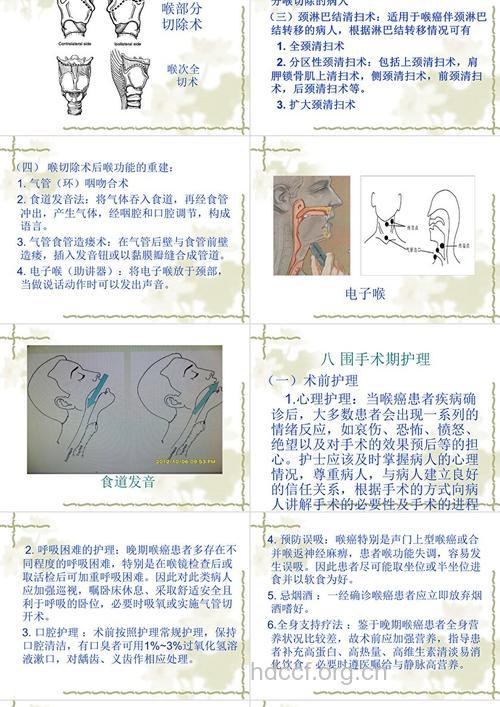 咽喉癌手术前如何护理