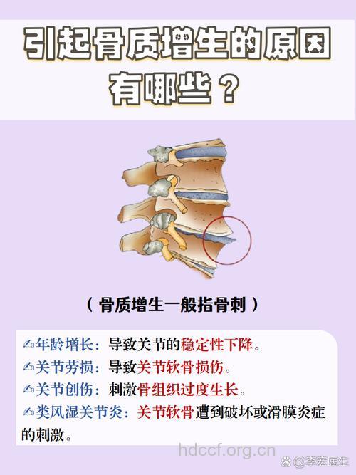 骨质增生的病因都有哪些