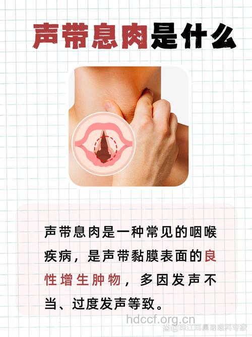声带息肉有什么危害