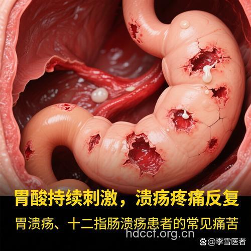 这些药物会引起消化性溃疡