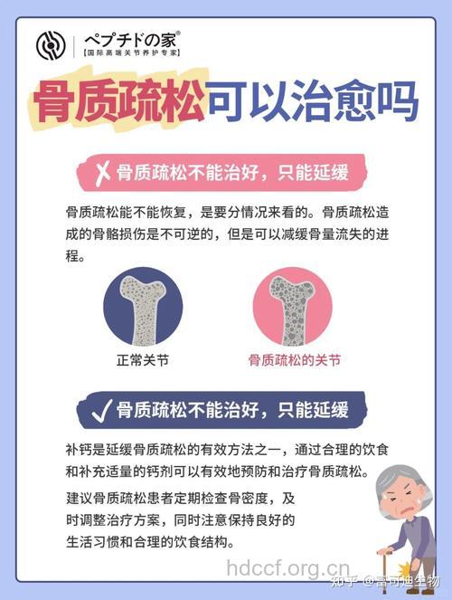 骨质疏松的治疗方法