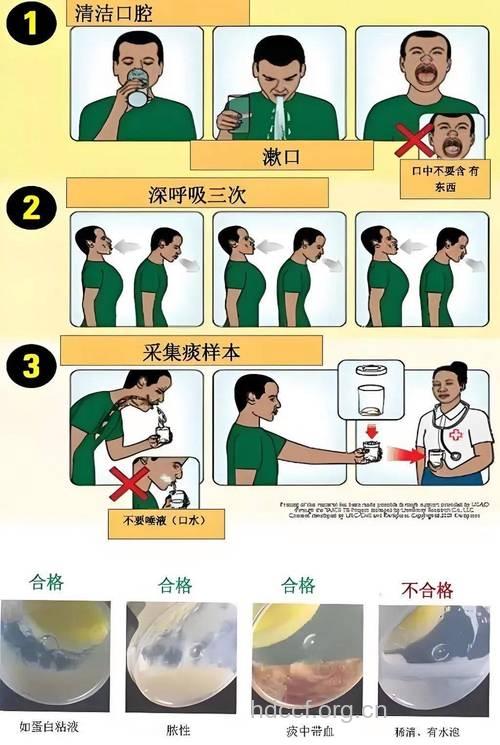 食管癌患者术后如何排痰