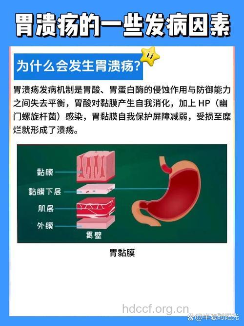影响胃溃疡的因素