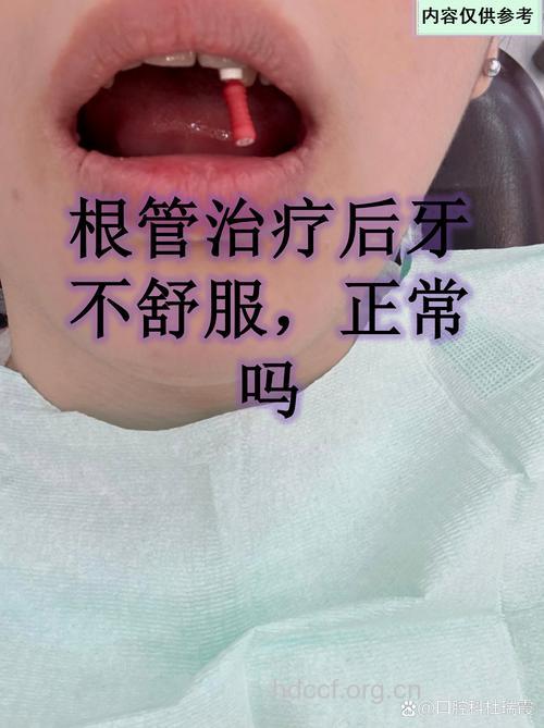 肿瘤者放疗后3年内少拔牙