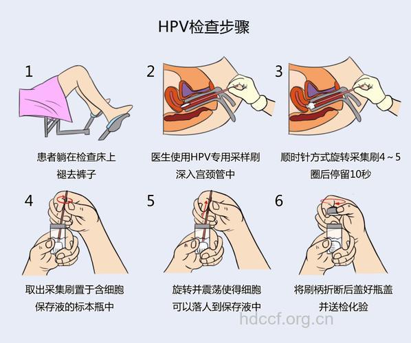 宫颈癌与性行为有什么关系