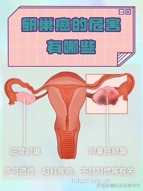 生育方式与女性肿瘤