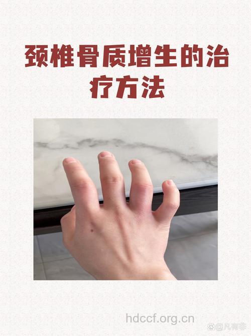 颈推骨质增生怎样自我治疗?