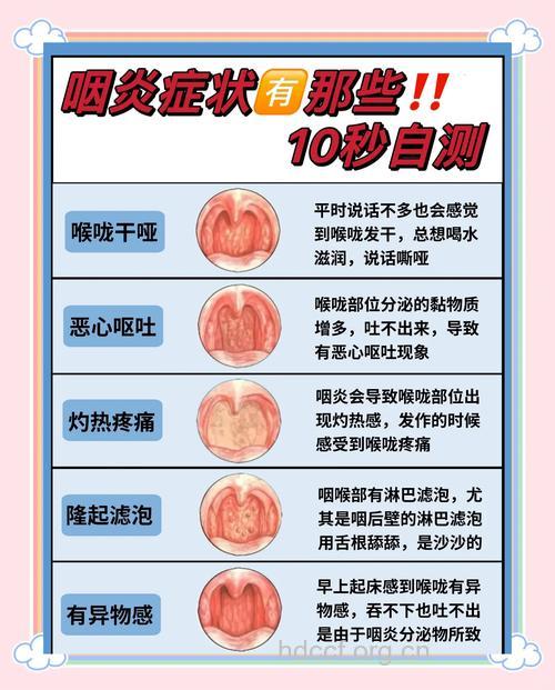 急性咽炎的症状及治疗方法