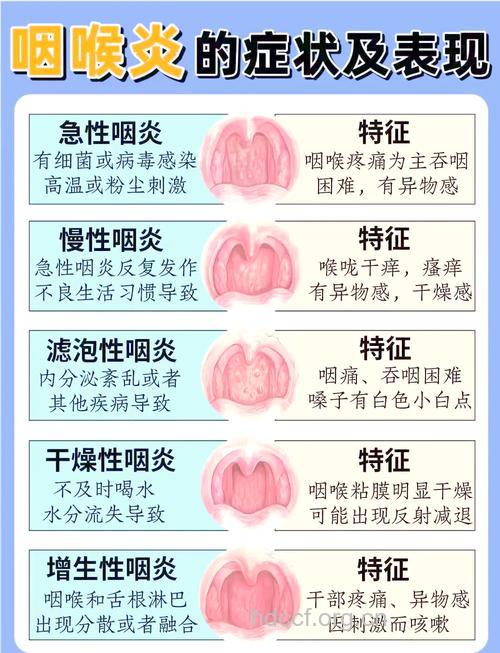 什么是急性咽炎