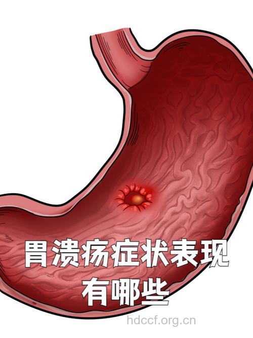 天气转凉小心胃溃疡找上门