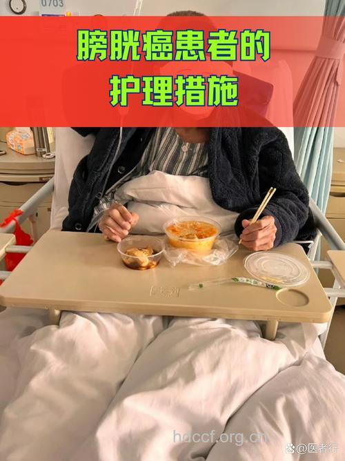 膀胱癌术后护理关键