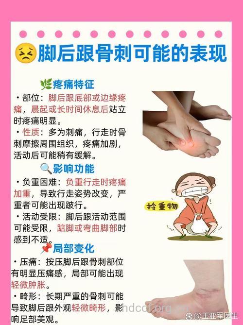 长了骨刺怎么办呢?