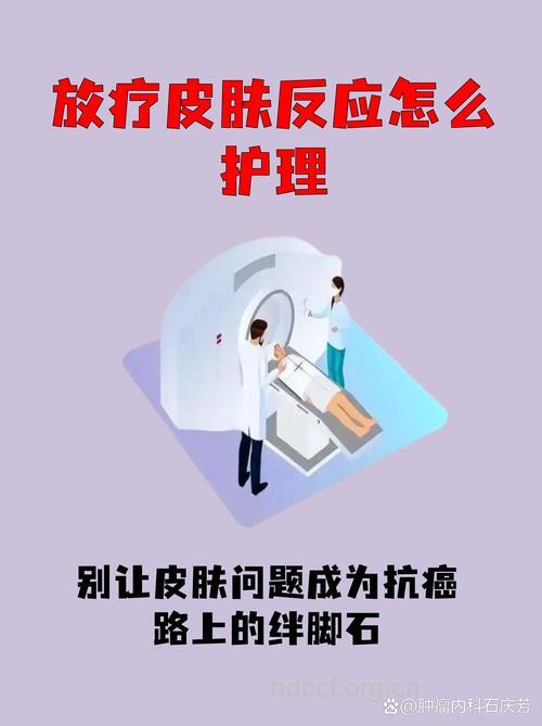 肿瘤放射治疗后的护理