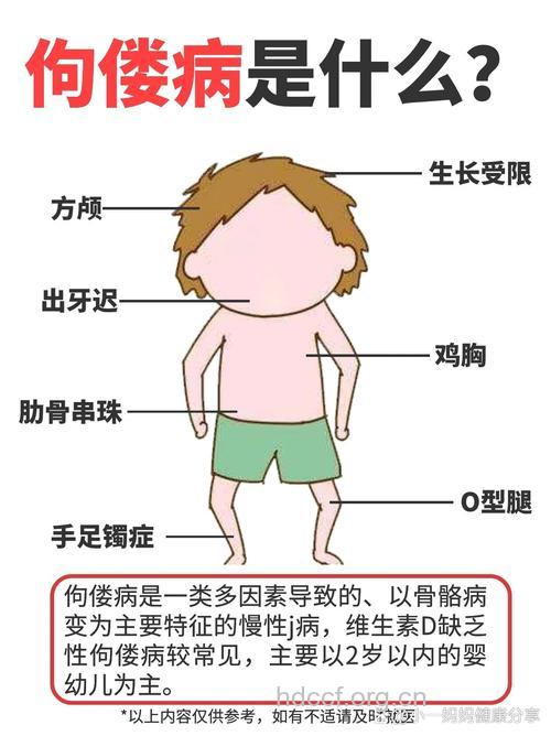 佝偻病的病因及异常表现