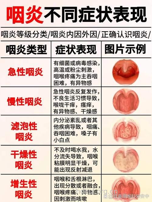 咽喉炎常见三大症状