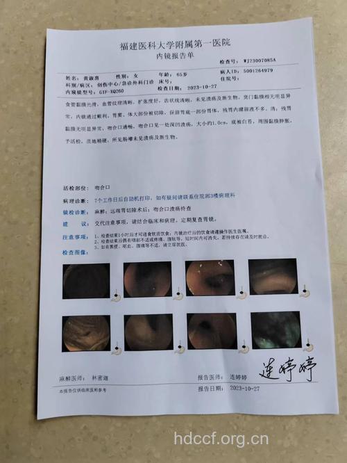 胃溃疡有何诊断依据