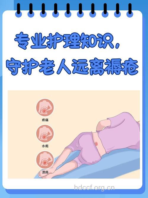 晚期肿瘤患者预防褥疮的护理