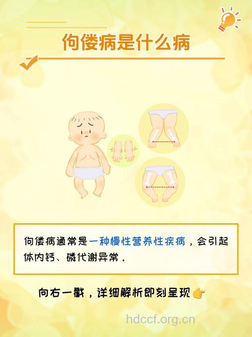 城市儿童为什么会导致佝偻病