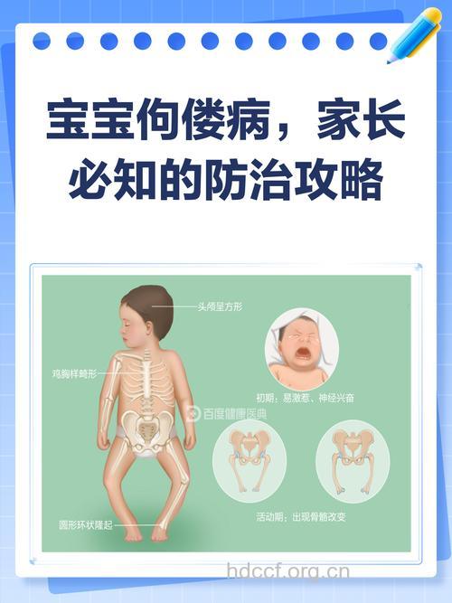 宝宝佝偻病有什么危害