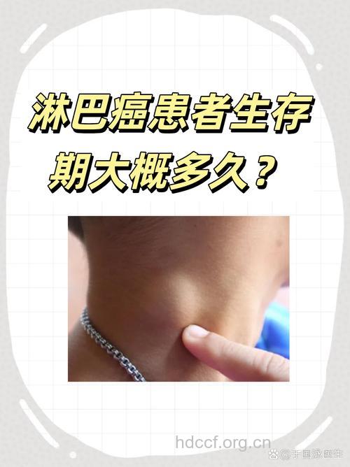 是什么心态让他二十一年战胜淋巴癌?