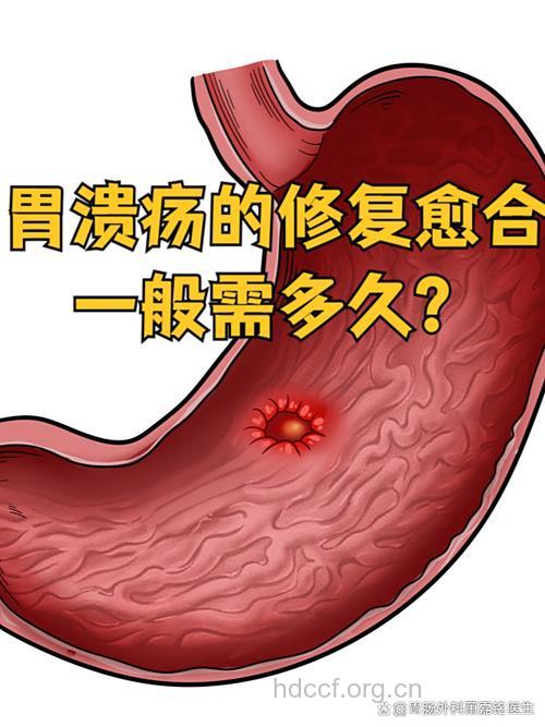 胃溃疡能否彻底治愈？要治多久？