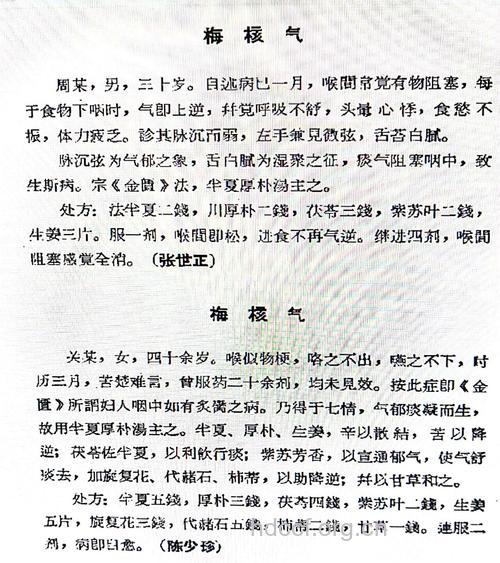 治疗梅核气的中药秘方