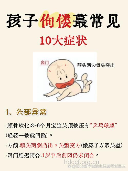 佝偻病的症状检查及治疗