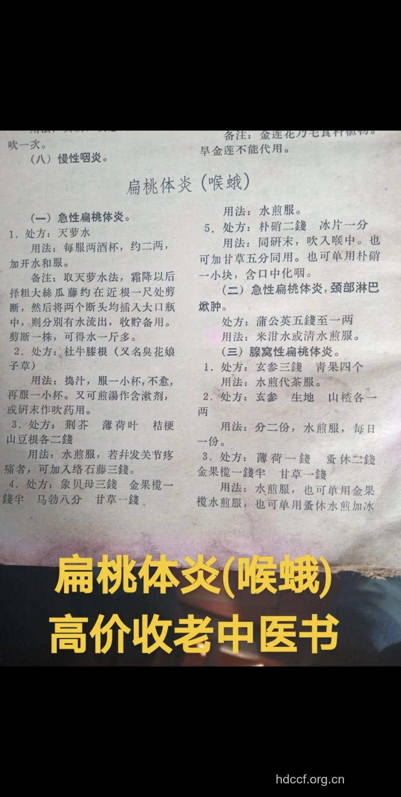 中药治疗扁桃体炎的偏方