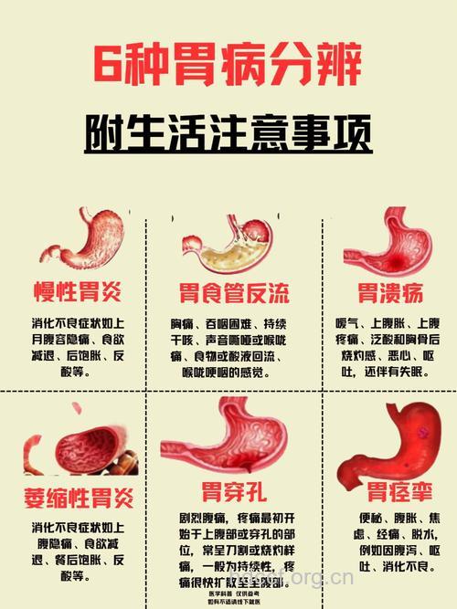 这些是误区-胃病患者留意!