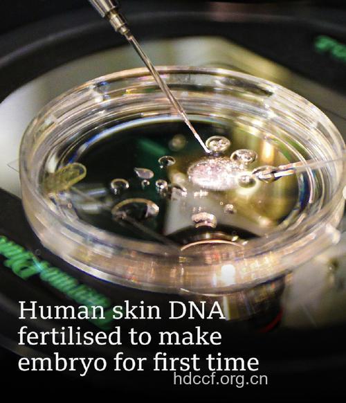 皮肤细胞培育精子 男性不育有望治疗
