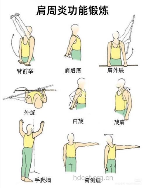 针对肩周炎的3A姿势诊断及疗法