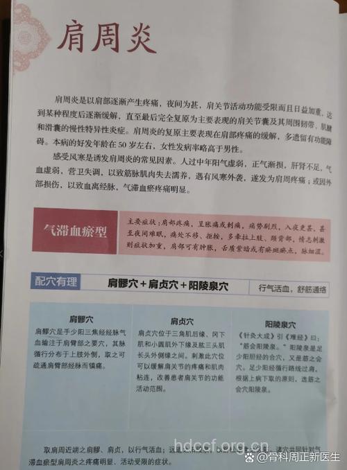 肩周炎在中医上的相关分型