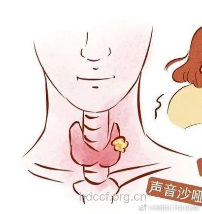 哪些因素会导致声带长茧