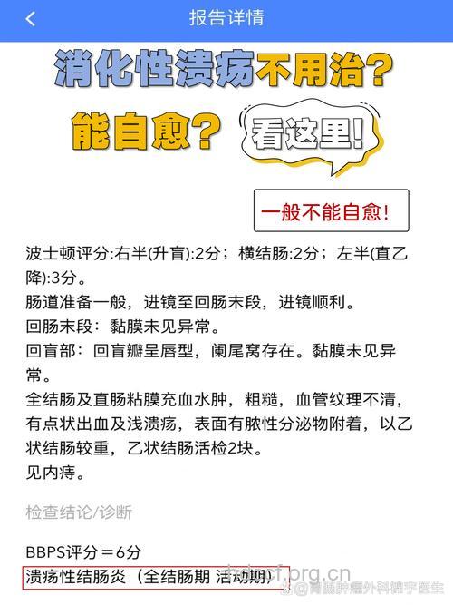 专家给胃溃疡患者的提议