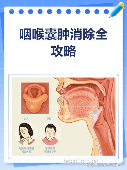 怎么正确应对扁桃体周围囊肿方法