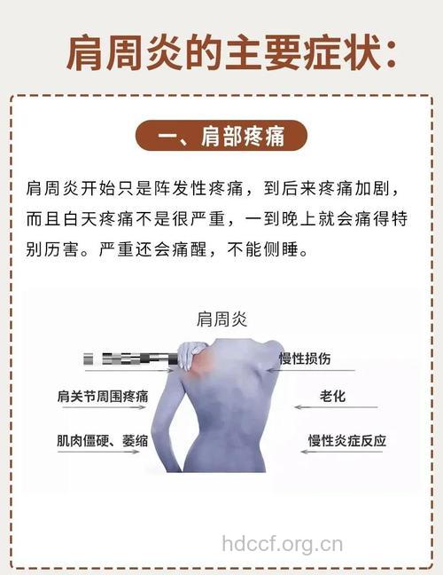 患上了肩周炎有什么症状