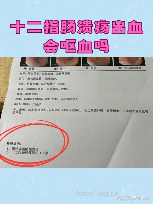 十二指肠出血如何诊断